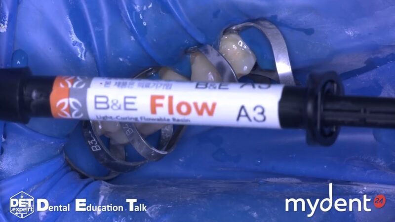 Case-04-BE-Flow-Xs-FiL-DET-expert-Mydent24-4K
