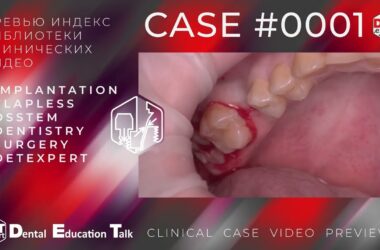 DET.expert-clinical-case-preview-0001-4K