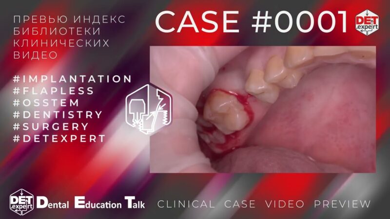 DET.expert-clinical-case-preview-0001-4K
